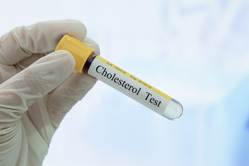 badanie cholesterol